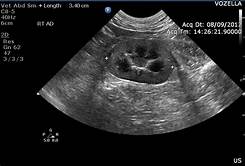 ultrasound, pregnancy, digital xray, specialist